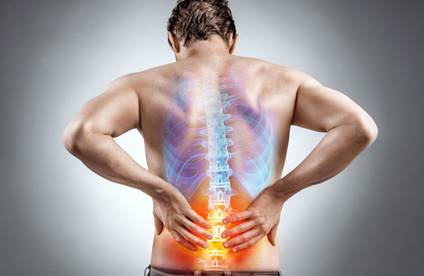 Discogenic Low Back Pain: Causes, Symptoms & Treatment Options